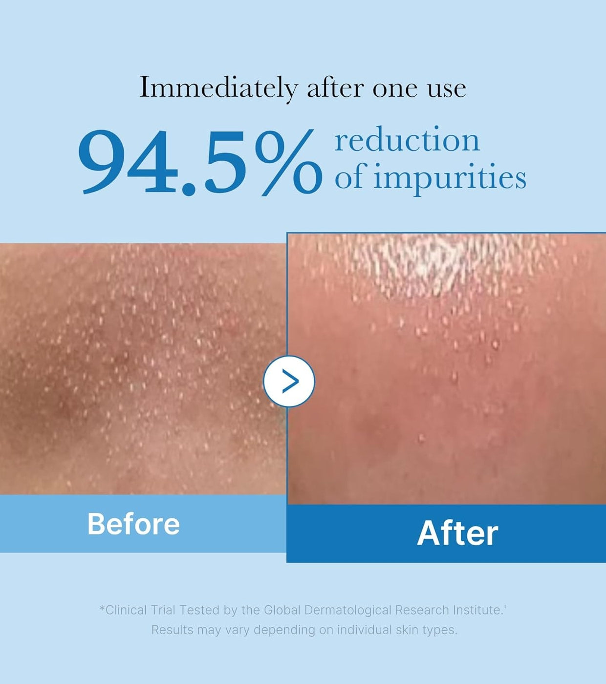 ميديكيوب - زيت التنظيف العميق للرؤوس السوداء بدون مسام