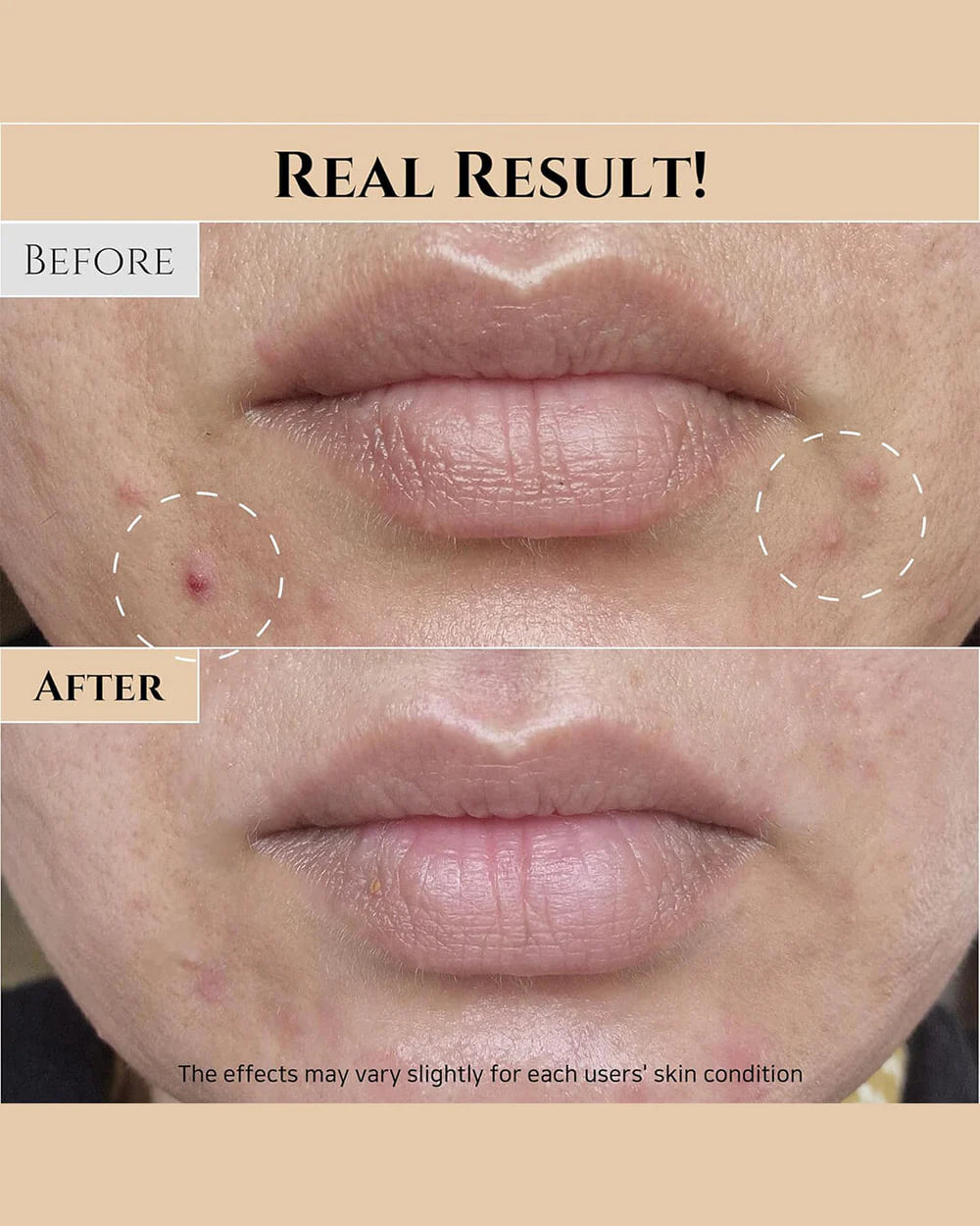 BEAUTY OF JOSEON Glow Replenishing Rice Milk - Moisturizing Lotion