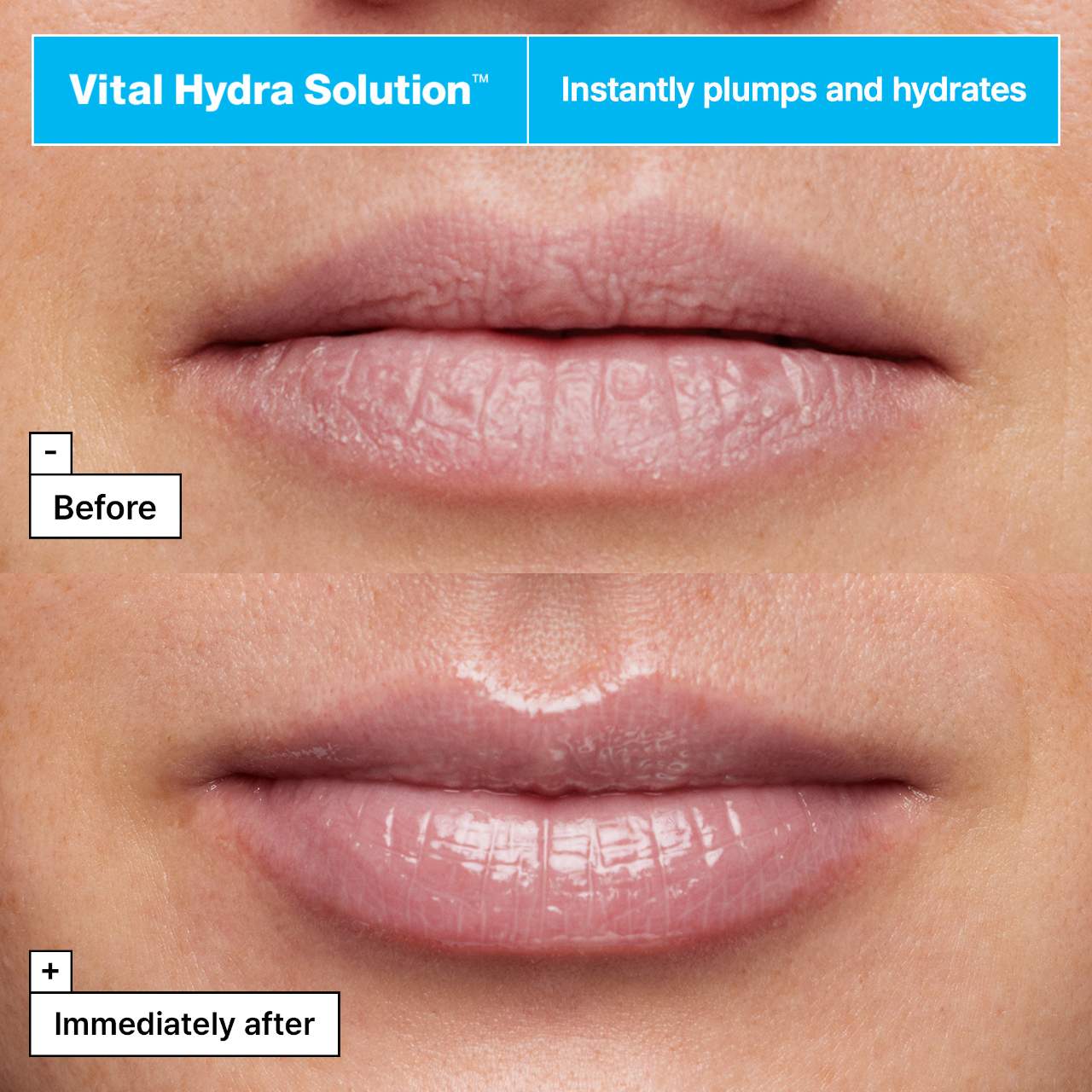 Dr.Jart+ Vital Hydra Solution™ Moisturizing Lip Mask – Plumping and Moisturizing Care with Hyaluronic Acid 