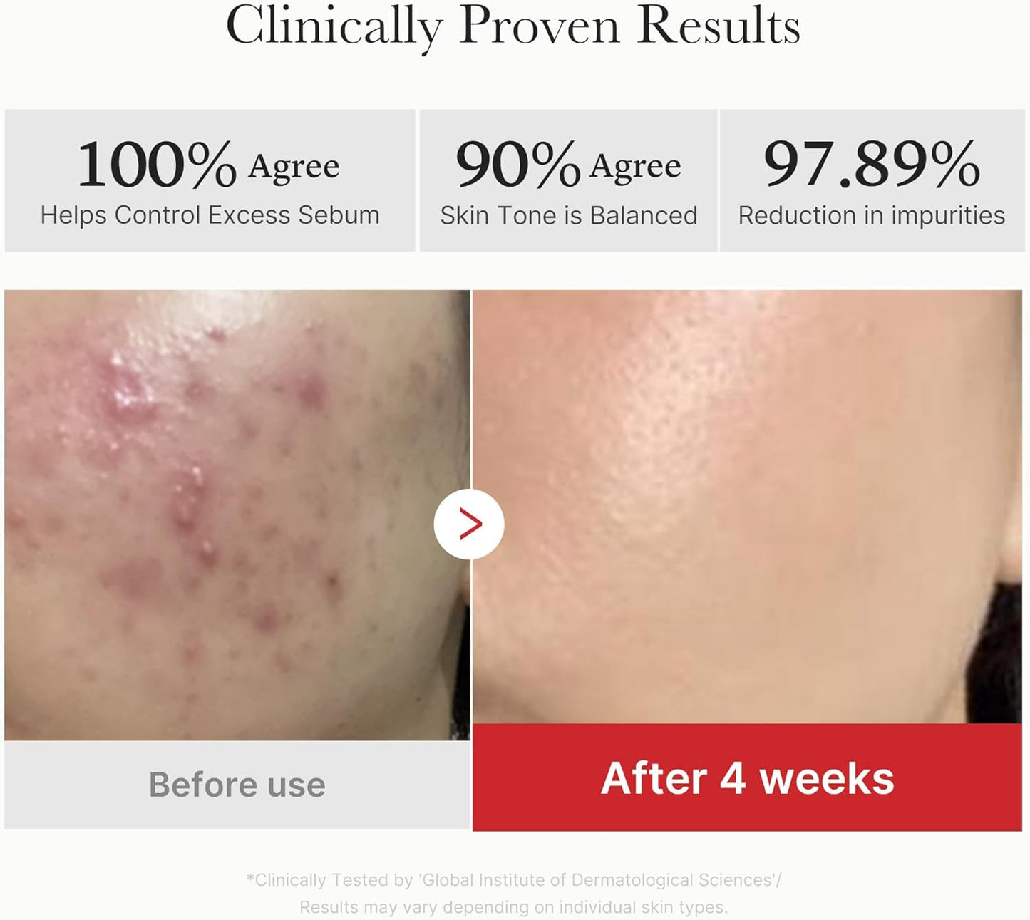 ميديكيوب - ضمادات حمض السكسينيك الأحمر والبانثينول (ضمادات تونيك حمض السكسينيك المضادة لحب الشباب والبقع والاحمرار)