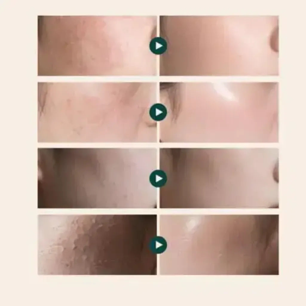 SEORY RECOMMENDATION REJUALL – Advanced PDRN Repair Cream (Night Repair Regenerating Cream)